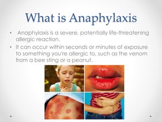 What is Anaphylaxis
• Anaphylaxis is a severe, potentially life-threatening
allergic reaction.
• It can occur within seconds or minutes of exposure
to something you're allergic to, such as the venom
from a bee sting or a peanut.
 