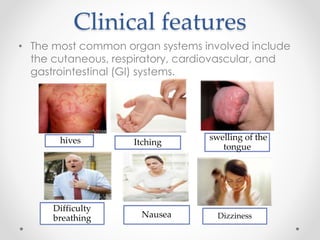 Clinical features
• The most common organ systems involved include
the cutaneous, respiratory, cardiovascular, and
gastrointestinal (GI) systems.
Difficulty
breathing DizzinessNausea
swelling of the
tongue
Itchinghives
 