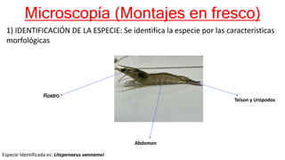 Microscopía (Montajes en fresco)
1) IDENTIFICACIÓN DE LA ESPECIE: Se identifica la especie por las características
morfológicas
Rostro
Abdomen
Telson y Urópodos
Especie Identificada es: Litopenaeus vannamei
 