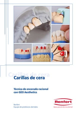 Ideas para la técnica dental
Paso a paso hacia el resultado
final
Paso a paso hacia el resultado
final
Su distribuidor: Puesto que nuestros productos están sometidos a un constante desa-
rrollo, las ilustraciones de éstos deberán considerarse solamente a título
orientativo.
En caso de un uso adecuado, Renfert concede una garantía de 3 años sobre
todos sus aparatos. Condición previa para las prestaciones de garantía es la
existencia de la factura original de compra de su distribuidor. Se excluyen de
estas prestaciones de garantía las piezas sometidas a un desgaste natural. La
garantía expira en caso de un uso inadecuado, en caso de no observar las
instrucciones de servicio, de limpieza, de mantenimiento o de conexión, al
igual que en caso de reparaciones por cuenta propia o reparaciones efec-
tuadas por personal no autorizado. La garantía expira igualmente en caso de
usar piezas de recambio de otros fabricantes, así como en caso de influencias
inusuales o no admisibles según las instrucciones de uso. Las prestaciones de
garantía no provocan ninguna prolongación del plazo de garantía.
1008A21-1032ES
Renfert
Equipo de protésicos dentales
Renfert GmbH | Industriegebiet | D - 78247 Hilzingen | Alemania
o: Postfach 1109 | D - 78247 Hilzingen | Alemania
Tel.: +49 (0)7731 8208-0 | Fax: 8208-70 | www.renfert.com | info@renfert.com
EE.UU./Canadá/México:
Renfert USA | 3718 Illinois Avenue | St. Charles IL 60174 | USA
Tel.: 630 762 1803 | Fax: 630 762 9787 | www.renfertusa.com | richardj@renfertusa.com
Free call 800 336 7422
Carillas de ceraCarillas de cera
Técnica de encerado racional
con GEO Aesthetics
Ideas para la técnica dental
 