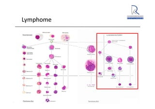 A. Wacker 2014
Lymphome
 
