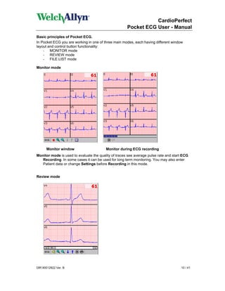CardioPerfect
                                                      Pocket ECG User - Manual
Basic principles of Pocket ECG.
In Pocket ECG you are working in one of three main modes, each having different window
layout and control button functionality:
    - MONITOR mode
    - REVIEW mode
    - FILE LIST mode

Monitor mode




      Monitor window                     Monitor during ECG recording
Monitor mode is used to evaluate the quality of traces see average pulse rate and start ECG
   Recording. In some cases it can be used for long term monitoring. You may also enter
   Patient data or change Settings before Recording in this mode.


Review mode




DIR 80012822 Ver. B                                                                   10 / 41
 