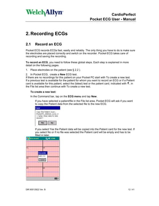 CardioPerfect
                                                           Pocket ECG User - Manual



2. Recording ECGs

2.1     Record an ECG
Pocket ECG records ECGs fast, easily and reliably. The only thing you have to do is make sure
the electrodes are placed correctly and switch on the recorder. Pocket ECG takes care of
recording and saving the recording.

To record an ECG, you need to follow these global steps. Each step is explained in more
detail on the following pages.
1. Place electrodes on the patient (see § 2.2 ).
2. In Pocket ECG, create a New ECG test.
If there are no recordings for this patient on your Pocket PC start with To create a new test.
If a previous test is available for the patient for whom you want to record an ECG or if a Patient
card is available for this patient, select the (latest) test or the patient card, indicated with , in
the File list area then continue with To create a new test.

    To create a new test:
    In the Command bar, tap on the ECG menu and tap New.
        If you have selected a patient/file in the File list area, Pocket ECG will ask if you want
        to copy the Patient data from the selected file to the new ECG.




        If you select Yes the Patient data will be copied into the Patient card for the new test. If
        you select No or if no file was selected the Patient card will be empty and has to be
        filled in later.




DIR 80012822 Ver. B                                                                            12 / 41
 