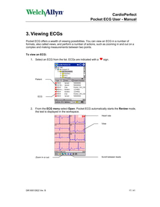 CardioPerfect
                                                      Pocket ECG User - Manual



3. Viewing ECGs
Pocket ECG offers a wealth of viewing possibilities. You can view an ECG in a number of
formats, also called views, and perform a number of actions, such as zooming in and out on a
complex and making measurements between two points.

To view an ECG:
    1. Select an ECG from the list. ECGs are indicated with a    sign.




        Patient




           ECG




    2. From the ECG menu select Open. Pocket ECG automatically starts the Review mode,
       the test is displayed in the workspace.
                                                                Heart rate


                                                                View




         Zoom in or out                                         Scroll between leads




DIR 80012822 Ver. B                                                                    17 / 41
 