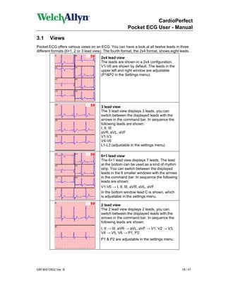 CardioPerfect
                                                         Pocket ECG User - Manual

3.1     Views
Pocket ECG offers various views on an ECG. You can have a look at all twelve leads in three
different formats (6+1, 2 or 3 lead view). The fourth format, the 2x4 format, shows eight leads.
                                        2x4 lead view
                                        The leads are shown in a 2x4 configuration.
                                        V1-V6 are shown by default. The leads in the
                                        upper left and right window are adjustable
                                        (P1&P2 in the Settings menu).




                                        3 lead view
                                        The 3 lead view displays 3 leads, you can
                                        switch between the displayed leads with the
                                        arrows in the command bar. In sequence the
                                        following leads are shown:
                                        I, II, III
                                        aVR, aVL, aVF
                                        V1-V3
                                        V4-V6
                                        L1-L3 (adjustable in the settings menu)

                                        6+1 lead view
                                        The 6+1 lead view displays 7 leads. The lead
                                        at the bottom can be used as a kind of rhythm
                                        strip. You can switch between the displayed
                                        leads in the 6 smaller windows with the arrows
                                        in the command bar. In sequence the following
                                        leads are shown:
                                        V1-V6 → I, II, III, aVR, aVL, aVF
                                        In the bottom window lead C is shown, which
                                        is adjustable in the settings menu.

                                        2 lead view
                                        The 2 lead view displays 2 leads, you can
                                        switch between the displayed leads with the
                                        arrows in the command bar. In sequence the
                                        following leads are shown:
                                        I, II → III, aVR → aVL, aVF → V1, V2 → V3,
                                        V4 → V5, V6 → P1, P2
                                        P1 & P2 are adjustable in the settings menu.




DIR 80012822 Ver. B                                                                        18 / 41
 