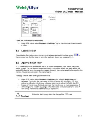 CardioPerfect
                                                            Pocket ECG User - Manual

                                                 Chart speed
                                                   Sensitivity




To set the chart speed or sensitivity:
    •   In the ECG menu, select Display and Settings. Tap on the drop down box and select
        a value.


3.5      Lead selector
Except for the 2x4 configuration you can scroll between leads with the blue arrows             in
the command bar. For the order in which the leads are shown see paragraph 3.1 .


3.6      Apply a notch filter
ECG traces can contain noise that is due to AC mains interference. This makes the traces
harder to read. You can filter out noise by applying a notch filter. When you apply a filter, the
original ECG signal is not permanently changed. You only change the way it is displayed on the
monitor. You can always restore the original signal.

To apply a notch filter while you view an ECG:

    •   In the ECG menu, select Display and Settings. And select a Notch filter and
        Strength. The Notch filter can be set on 50Hz (Europe), 60Hz (USA) or Off. If no
        extensive AC mains interference exists we recommend setting the Notch filter Off.
    •   In case of interference, first try to eliminate that interference as much as possible. If
        eliminating is not possible try using a notch filter set to normal strength or in case of
        very strong interference set it to strong or aggressive.


                        Extensive filtering may affect the shape of the ECG trace
        Caution




DIR 80012822 Ver. B                                                                           20 / 41
 