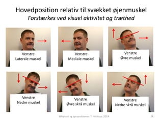 Hovedposition relativ til svækket øjenmuskel 
Forstærkes ved visuel aktivitet og træthed 
Venstre 
Laterale muskel 
Venstre 
Mediale muskel 
Venstre 
Øvre muskel 
Venstre 
Nedre muskel 
Venstre 
Øvre skrå muskel 
Venstre 
Nedre skrå muskel 
Whiplash og synsproblemer. T. Helstrup. 2014 24 
 