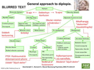 General approach to diplopia. 
Et øje To øjne 
Okulær rotation 
cylinderakse ! 
Danchaivijitr C , Kennard C J Neurol Neurosurg Psychiatry 2004;75:iv24-iv31 
©2004 by BMJ Publishing Group Ltd 
Blikafhængig 
”skelevinkel” 
Hovedstillingsfejl 
25 
Dobbeltsyn 
Konfusion 
Dobbelt 
konturering 
Brillefejl 
PTDF: Posttraumatisk 
dekompenseret phorie 
Ustabil ”Skjult skelen” 
Fejlkompenseret 
via nærrefleks 
Maskeret ”skjult skelen” 
Nedbrud af 
fusionsevne 
 