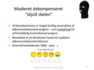 Maskeret dekompenseret 
”skjult skelen” 
• Virkemekanismen er meget kraftig anvendelse af 
akkommodationskonvergens – som erstatning for 
utilstrækkelig fusionskonververgens. 
• Resultatet er en binokulær hysterisk reaktion i 
akkommodationsfunktionen 
Whiplash og synsproblemer. T. Helstrup. 2014 
26 
• Smertefremkaldende: Mild - svær 
 