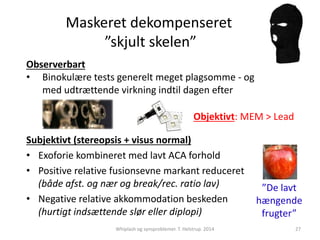Maskeret dekompenseret 
”skjult skelen” 
Observerbart 
• Binokulære tests generelt meget plagsomme - og 
med udtrættende virkning indtil dagen efter 
Objektivt: MEM > Lead 
Subjektivt (stereopsis + visus normal) 
• Exoforie kombineret med lavt ACA forhold 
• Positive relative fusionsevne markant reduceret 
(både afst. og nær og break/rec. ratio lav) 
• Negative relative akkommodation beskeden 
(hurtigt indsættende slør eller diplopi) 
”De lavt 
hængende 
frugter” 
Whiplash og synsproblemer. T. Helstrup. 2014 27 
 