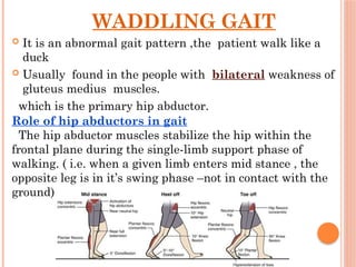 Waddlinggait 200705041937 pptx PPTX