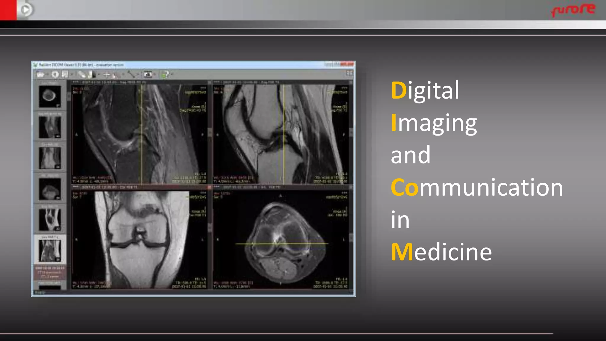 Digital 
Imaging 
and 
Communication 
in 
Medicine 
 