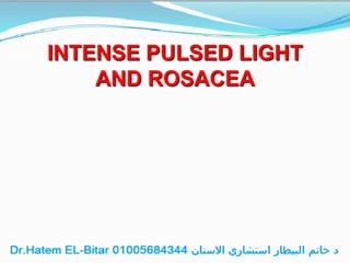 INTENSE PULSED LIGHT
AND ROSACEA
 