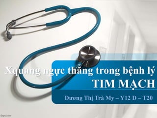 Xquang ngực thẳng trong bệnh lý
TIM MẠCH
Dương Thị Trà My – Y12 D – T20
 