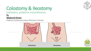 Colostomy & Ileostomy
Indications, problems and preference
By
Waleed Omar
Professor of Colorectal surgery, Mansoura University.
 
