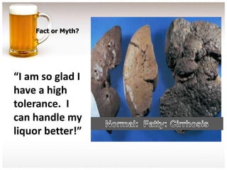 Fact or Myth?




“I am so glad I
have a high
tolerance. I
can handle my
liquor better!”
 
