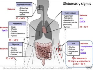 Reber, Laurent, Hernandez, Joseph, Galli, Stephen. The pathphysiology of anaphylaxis. J Allergy Clin Imunol. (2017). Vol 140, Number 2
Síntomas y signos
Más frecuentes
Urticaria y angioedema
en 62 – 90 %
15 – 50 %
30 - 35 %
45 – 60 %
25 – 30 %
Dra. Santoyo
CRAIC Mty
 