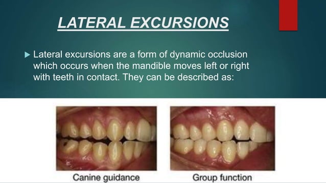 Dentistry pptx on topic of normal occlusion | PPT