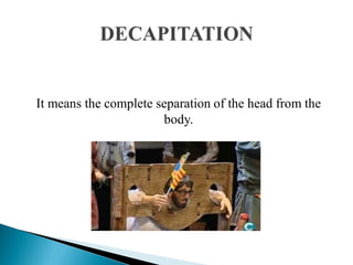 It means the complete separation of the head from the
body.
 