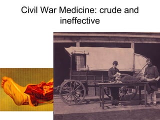 Civil War Medicine: crude and
ineffective
 