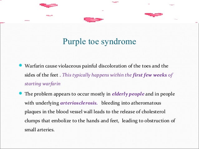 Warfarin Oral Anticoagulant