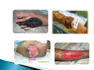 Hitam Kuning
Pink
Merah
 