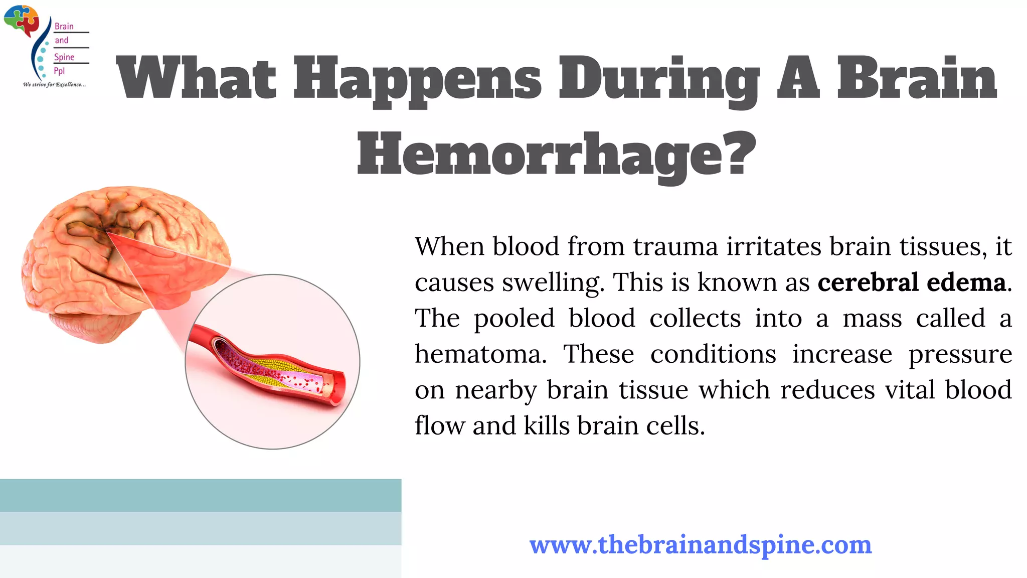 Warning Signs Of Brain Hemorrhage | PPT