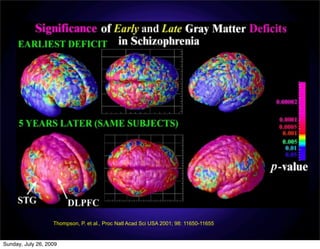 Thompson, P. et al., Proc Natl Acad Sci USA 2001; 98: 11650-11655


Sunday, July 26, 2009
 