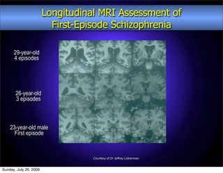 Longitudinal MRI Assessment of
                          First-Episode Schizophrenia

      29-year-old
      4 episodes




       26-year-old
       3 episodes



    23-year-old male
      First episode


                                   Courtesy of Dr Jeffrey Lieberman


Sunday, July 26, 2009
 