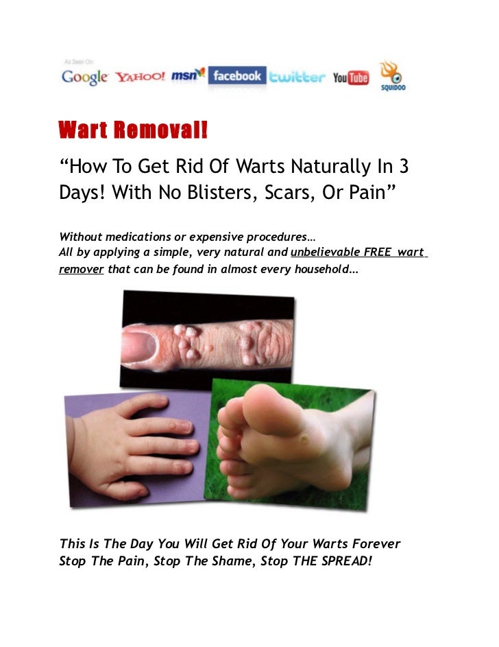 Wart Removal How To Get Rid Of Warts NaturallyIn3Days! With No B…