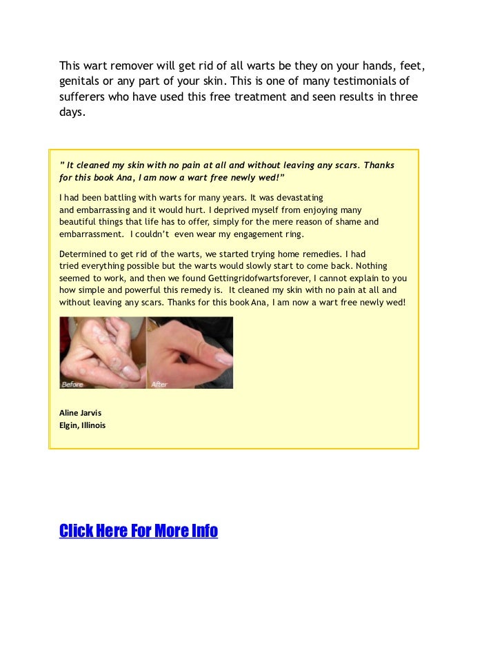 How To Get Rid Of Blisters On Feet Naturally How To Get Rid Of Blisters On Feet Naturally