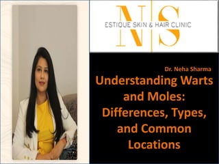 Understanding Warts
and Moles:
Differences, Types,
and Common
Locations
Dr. Neha Sharma
 