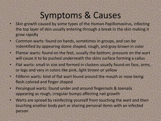 Warts | PPTX
