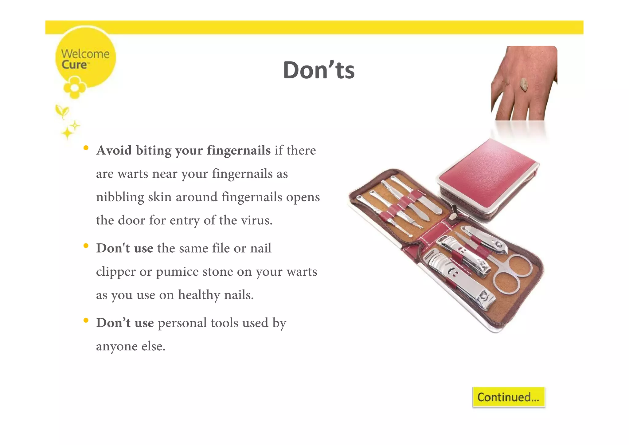 Don’ts
•
•
•
 