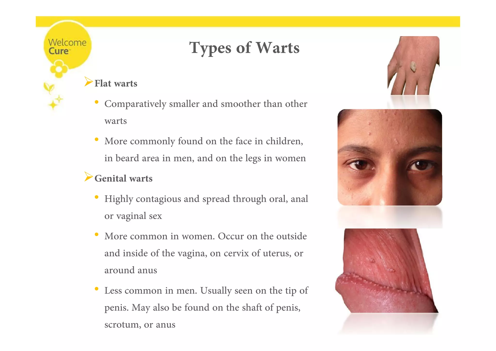 
•
•

•
•
•
 