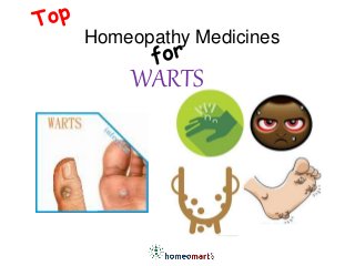 WARTS
Homeopathy Medicines
 