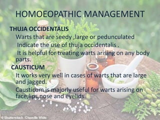 HOMOEOPATHIC MANAGEMENT
THUJA OCCIDENTALIS
Warts that are seedy ,large or pedunculated
Indicate the use of thuja occidentalis .
It is helpful for treating warts arising on any body
parts.
CAUSTICUM
It works very well in cases of warts that are large
and jagged.
Causticum is majorly useful for warts arising on
face,lips,nose and eyelids.
 