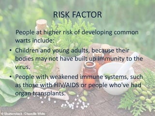 RISK FACTOR
People at higher risk of developing common
warts include:
• Children and young adults, because their
bodies may not have built up immunity to the
virus.
• People with weakened immune systems, such
as those with HIV/AIDS or people who've had
organ transplants.
 