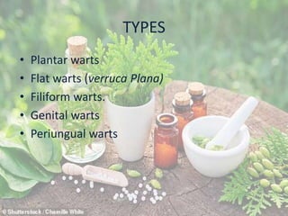 TYPES
• Plantar warts
• Flat warts (verruca Plana)
• Filiform warts.
• Genital warts
• Periungual warts
 
