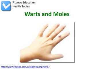 Fitango Education
          Health Topics

                    Warts and Moles




http://www.fitango.com/categories.php?id=67
 