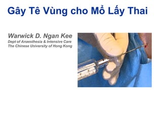 Gây Tê Vùng cho Mổ Lấy Thai 
Warwick D. Ngan Kee 
Dept of Anaesthesia & Intensive Care 
The Chinese University of Hong Kong 
 
