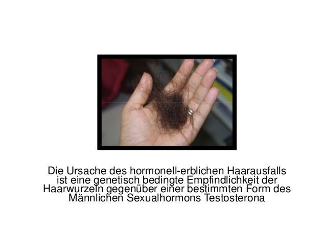 Was Hilft Gegen Kreisrunder Haarausfall de.slideshare.net