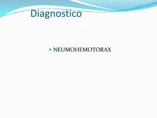 Diagnostico
 NEUMOHEMOTORAX
 