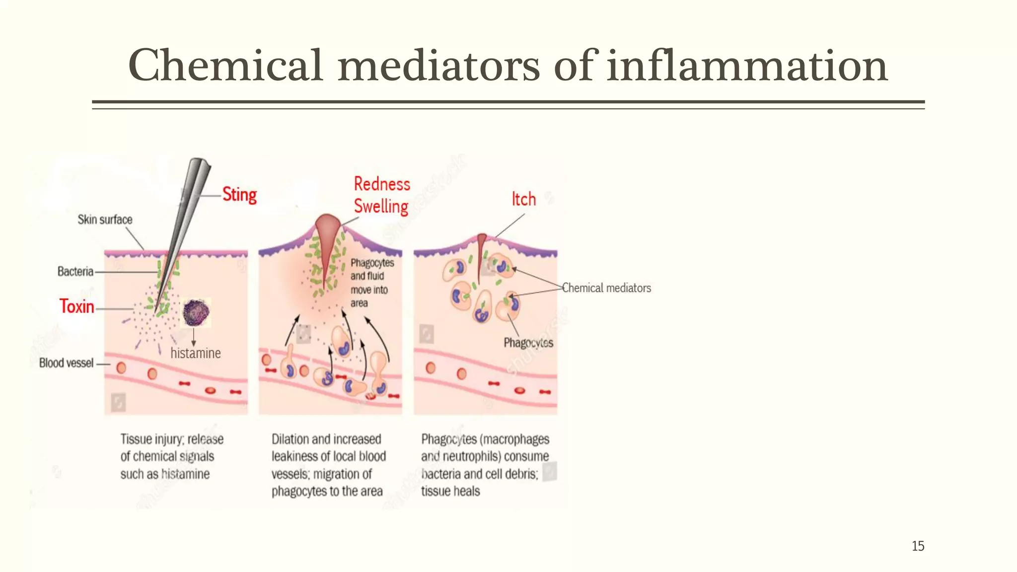 Chemical mediators of inflammation
15
 