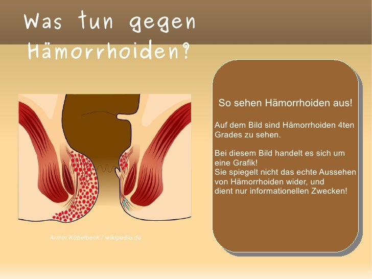 Der Schmerz unten des Bauches und den Pfahl in den Anus