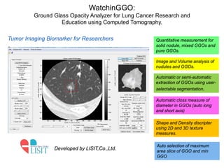 WatchinGGO: 
Ground Glass Opacity Analyzer for Lung Cancer Research and Education using Computed Tomography. 
Developed by LISIT,Co.,Ltd. 
Quantitative measurement for solid nodule, mixed GGOs and pure GGOs. 
Image and Volume analysis of nudules and GGOs. 
Automatic or semi-automatic extraction of GGOs using user- selectable segmentation. 
Automatic closs measure of diameter in GGOs (auto long and short axis) 
Shape and Density discripter using 2D and 3D texture measures. 
Auto selection of maximum area slice of GGO and min GGO 
Tumor Imaging Biomarker for Researchers  