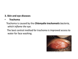 3. Skin and eye diseases
• Trachoma
Trachoma is caused by the Chlamydia trachomatis bacteria,
which inflame the eye.
The best control method for trachoma is improved access to
water for face washing.
 