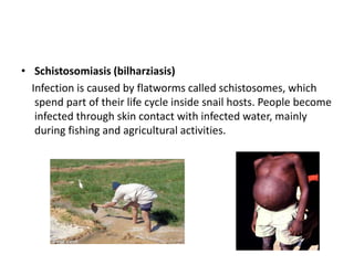 • Schistosomiasis (bilharziasis)
Infection is caused by flatworms called schistosomes, which
spend part of their life cycle inside snail hosts. People become
infected through skin contact with infected water, mainly
during fishing and agricultural activities.
 