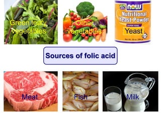 Sources of folic acid
Green leafy
vegetables
Other
vegetables
Fish MilkMeat
Yeast
 