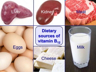 Dietary
sources of
vitamin B12
Eggs
Liver Kidney Meat
Cheese
Milk
 